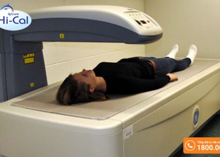 X quang loãng xương: các phương pháp chẩn đoán xác định bệnh