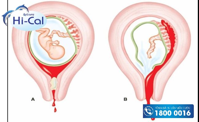 sau sinh bao lâu hết sản dịch