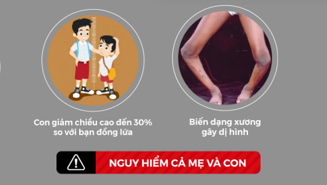 Mẹ bầu thiếu canxi ảnh hưởng đến trẻ