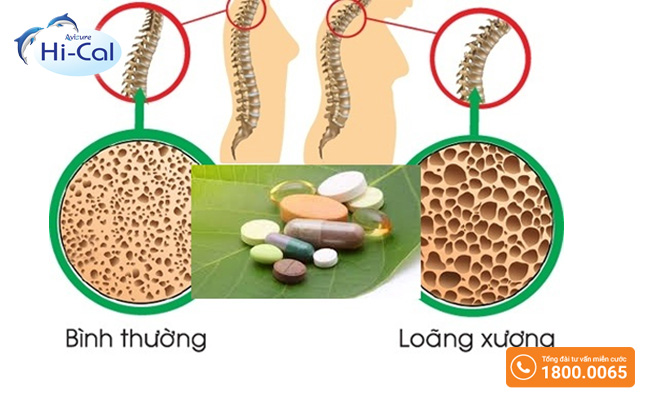 Bổ sung canxi cho bộ xương răng chắc khỏe